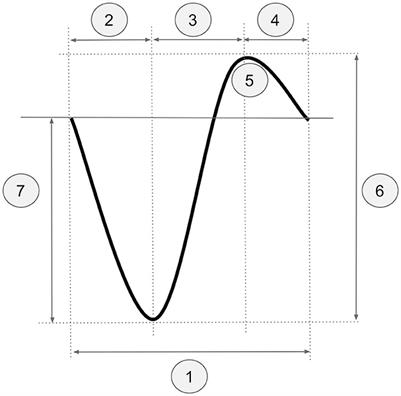 Improving the detection of sleep slow oscillations in electroencephalographic data